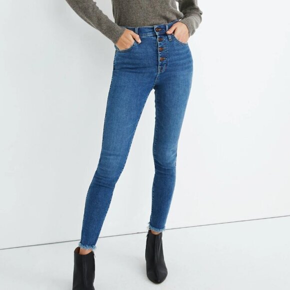 Madewell 10" High-Rise Skinny:Button Front Edition - Picture 1 of 14